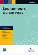 Tumeurs_du_cerveau