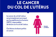 Infographie-Depistage-du-cancer-du-col-de-l-uterus